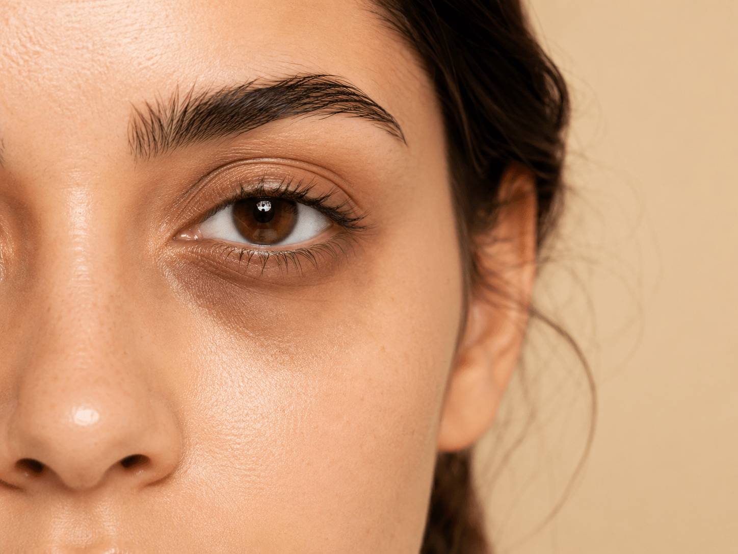 Dark Circles Under Eyes skincare guide